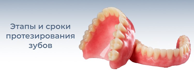 протезирование зубов на 4 имплантах