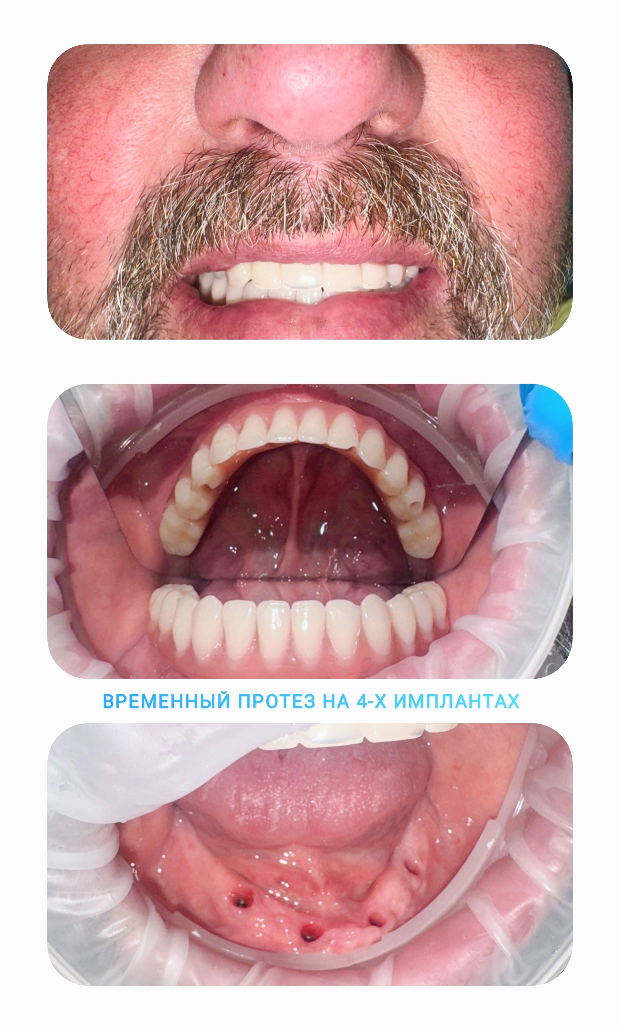 Посмотреть крупнее